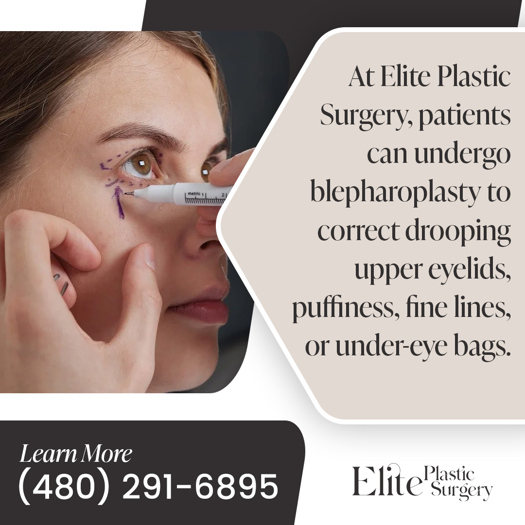 Upper Eyelid Vs. Lower Eyelid Blepharoplasty